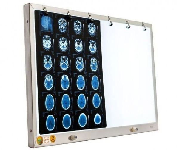 Đèn led đọc 2 phim X-quang Bayoka- Việt Nam